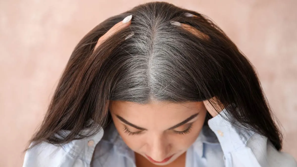 how to change grey hair to black hair in just 2 steps? | இளைஞர்களின் இளநிரையை  எளிதில் போக்கும் இரண்டு எளிய டிப்ஸ்! இதோ உங்களுக்காக 