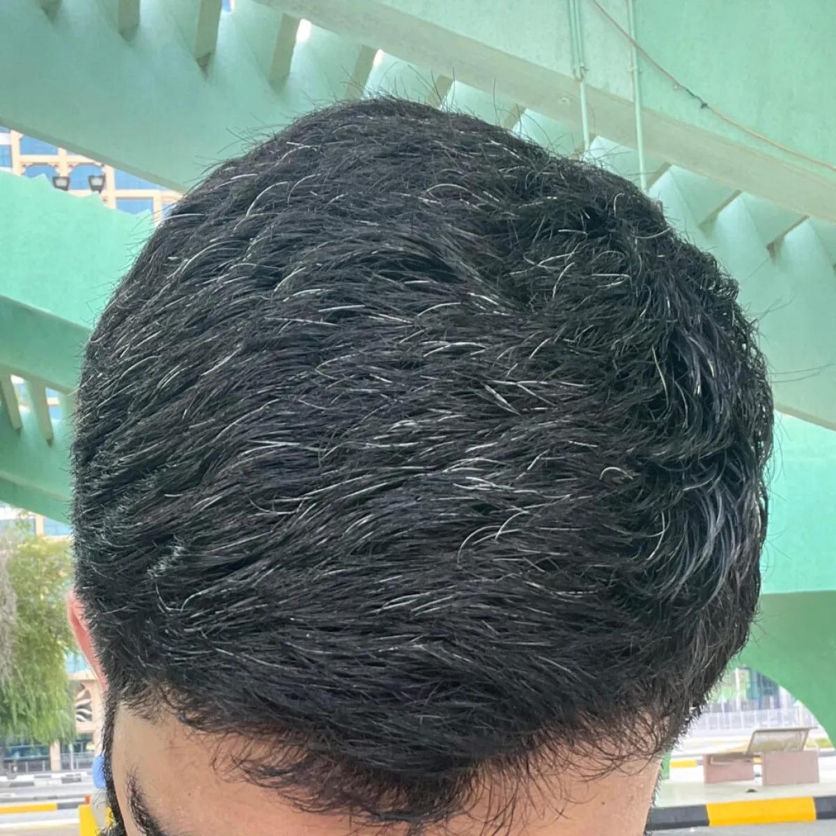 Just 1 secret for remove grey hair on young age | இந்த ஒரு ரகசியம் தெரிந்தால் போதும்! இனி உங்களுக்கு இளநரையே வராது!